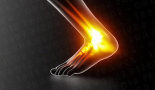 1001pieds ™ clinique du pieds val-morin