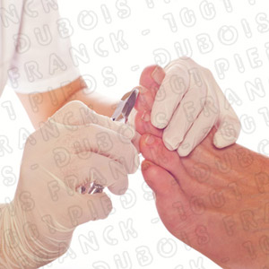 1001pieds ™ ongle incarné, jauni, mycose