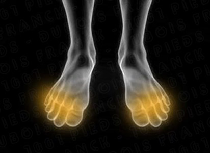 massage metamorphique val-morin 1001pieds ™ la force-intérieure